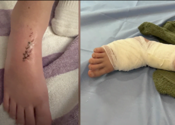 Niño estadounidense sobrevive ataque de tiburón en playa costarricense