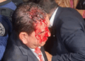 Turba oficialista agrede a diputados opositores en Congreso de Honduras