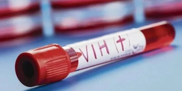 Salud descarta aumento de casos de VIH en El Salvador durante 2025