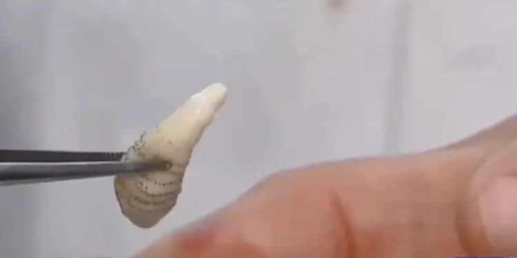 Honduras registra más de 25 personas infectadas por larvas del gusano barrenador