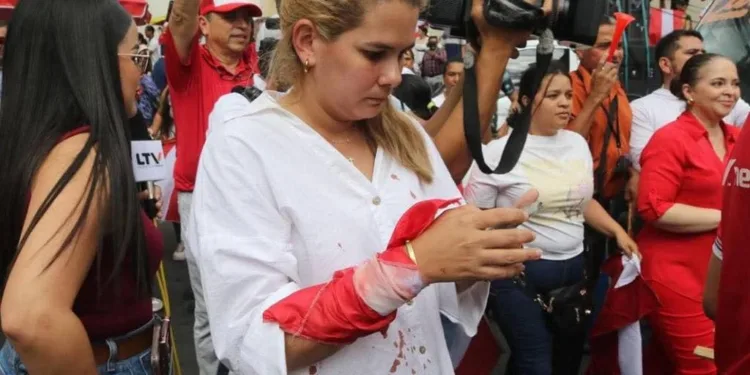 Partido Liberal de Honduras denuncia represión del gobierno y advierte sobre atentados a libertades democráticas