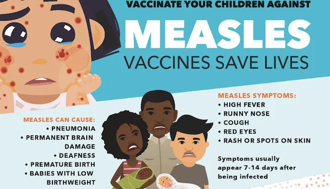 Belice asegura que logró controlar el brote de sarampión tras 34 casos