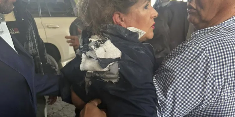 “Lo perdono”: Diputada herida con explosivo en Honduras presenta quemaduras de segundo y tercer grado