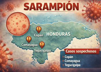 Honduras detecta cuatro casos sospechosos de sarampión tras 27 años sin contagios locales