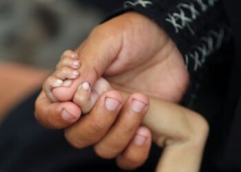 Costa Rica registra menos del 2,5 % de desnutrición y se ubica entre los países con mejores cifras de América Latina