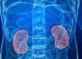 Casos de cáncer de riñón aumentaron 18 % en Costa Rica durante el último año