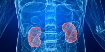 Casos de cáncer de riñón aumentaron 18 % en Costa Rica durante el último año