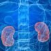 Casos de cáncer de riñón aumentaron 18 % en Costa Rica durante el último año