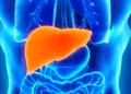 Consultas por hepatitis crónica aumentaron 31.6 % en Costa Rica durante el primer semestre de 2026