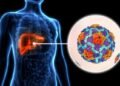 EE.UU. alerta por brote de hepatitis A en Costa Rica