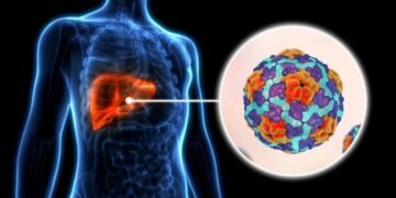 EE.UU. alerta por brote de hepatitis A en Costa Rica